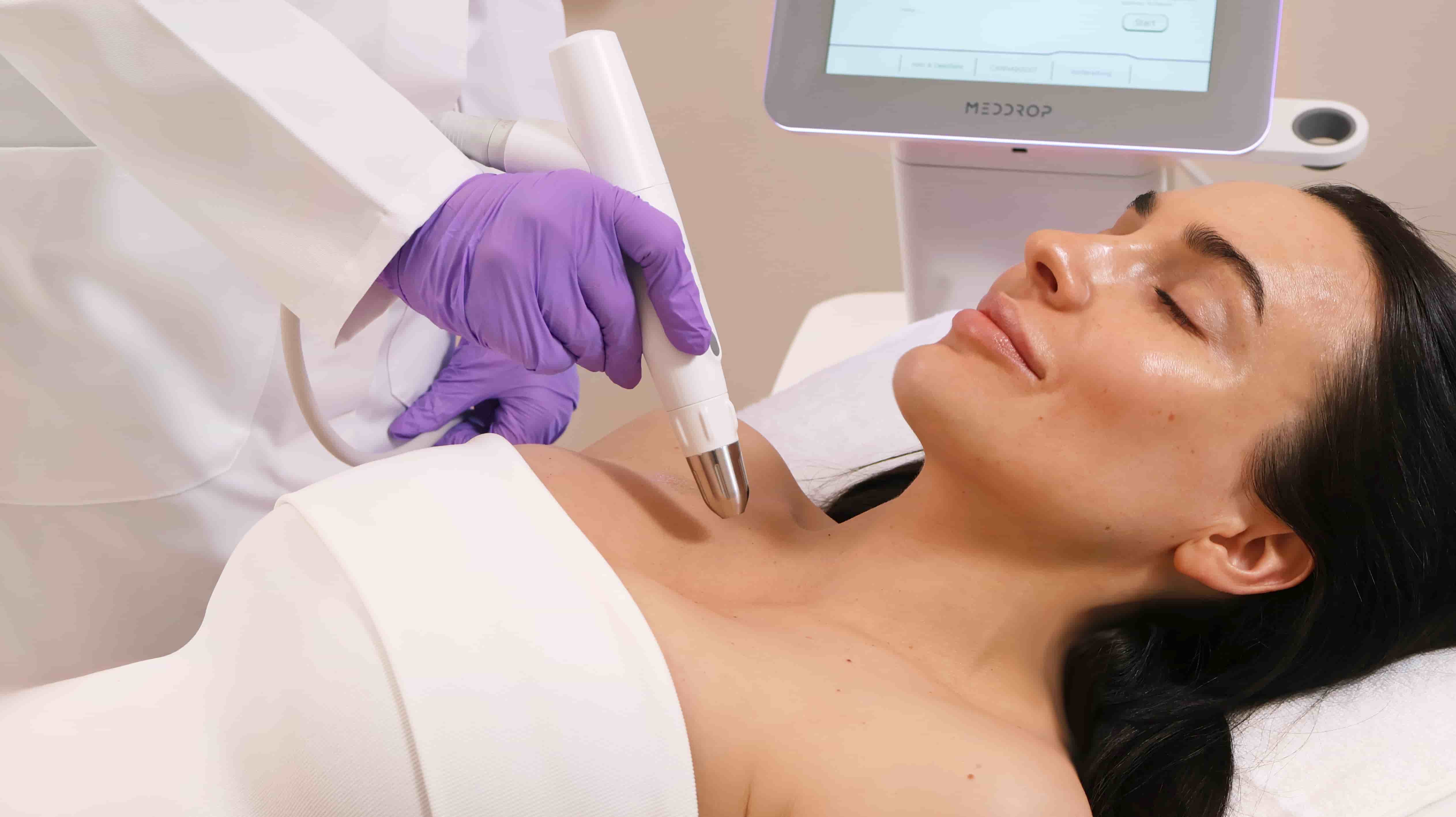 Dermadrop-Behandlung am Décolleté